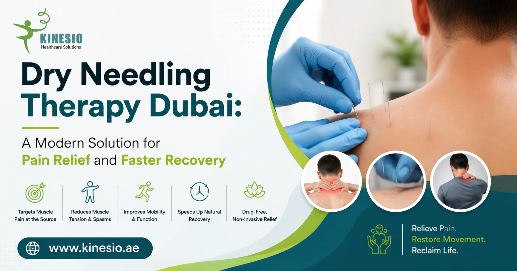 Dry Needling Therapy Dubai offers a modern solution for pain relief, reducing muscle tension, improving mobility, and accelerating recovery naturally.