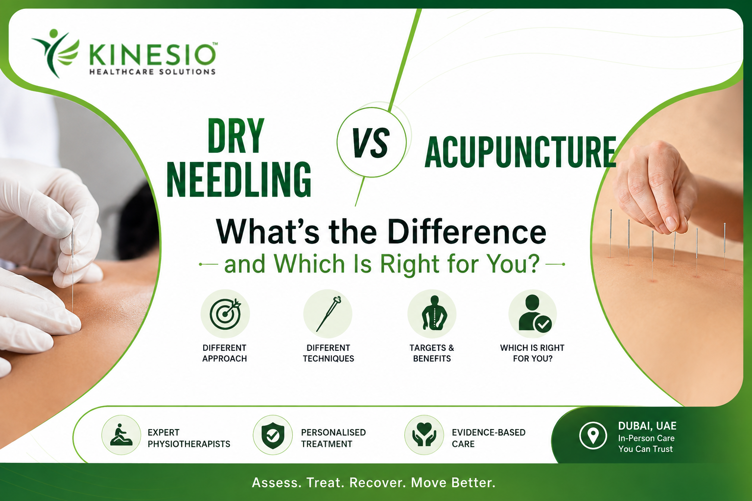 Dry needling vs acupuncture treatment comparison in Dubai